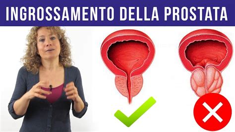 La prostata femminile: dove si trova